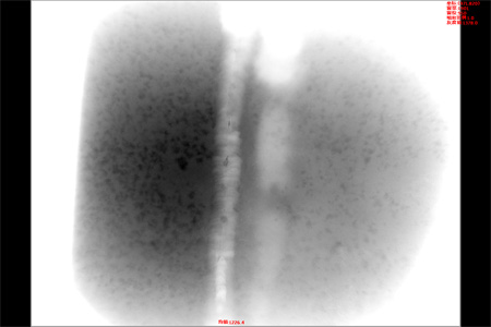 x ray image 02